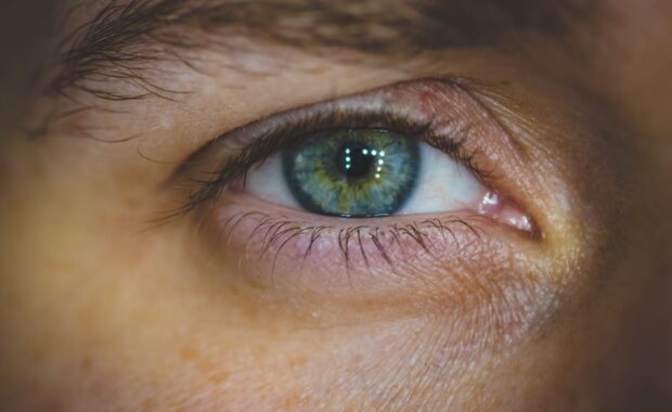 opadająca powieka co zrobić